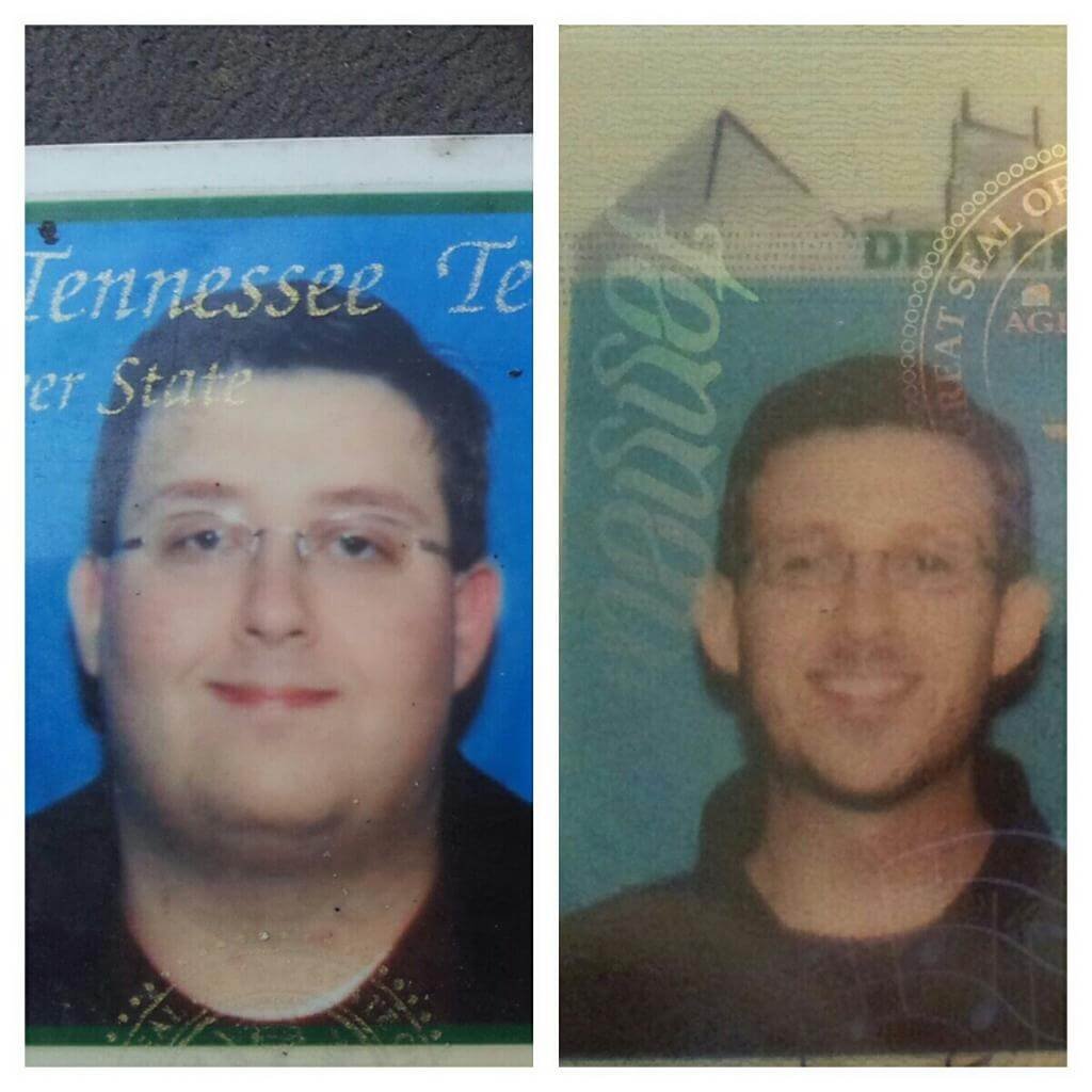 Before and After Weight Loss Face